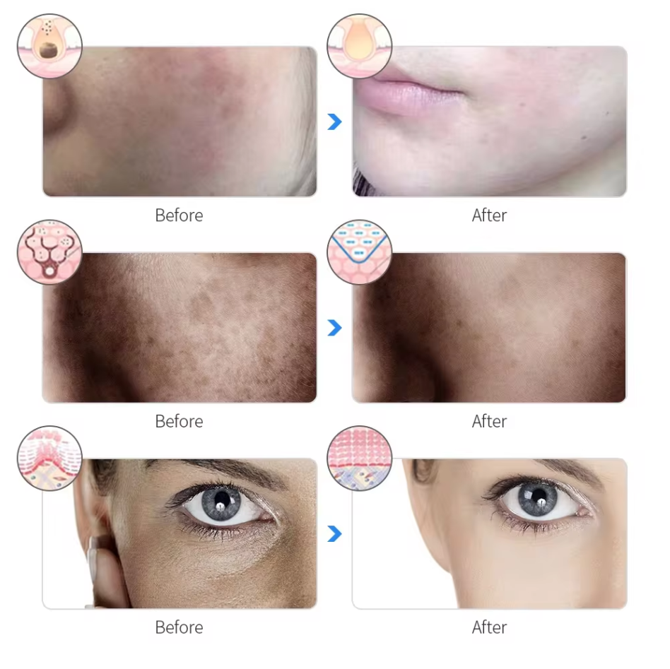 ElaraCraft™ Light Therapy Mask