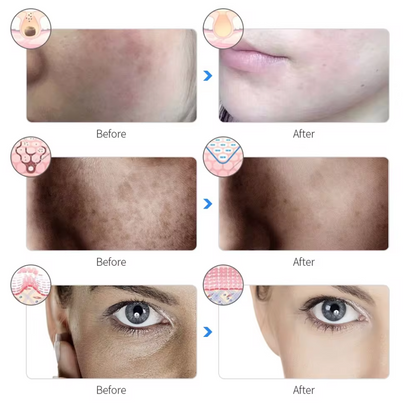 ElaraCraft™ Light Therapy Mask